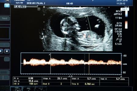 В роддоме больницы Вересаева начали определять резус-фатор еще не родившегося малыша