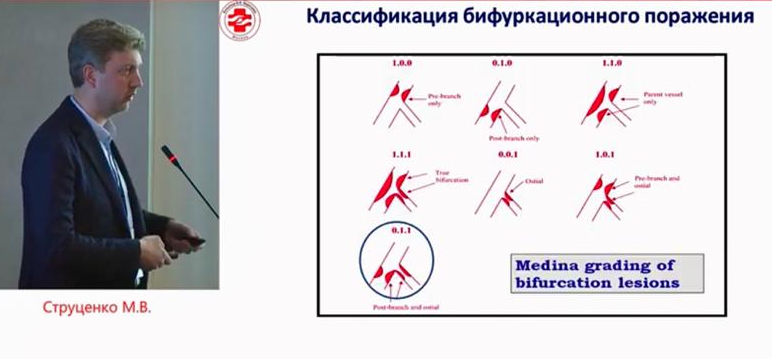 Опыт рентгенохирургов больницы Вересаева широко транслируется на профильных медицинских мероприятиях