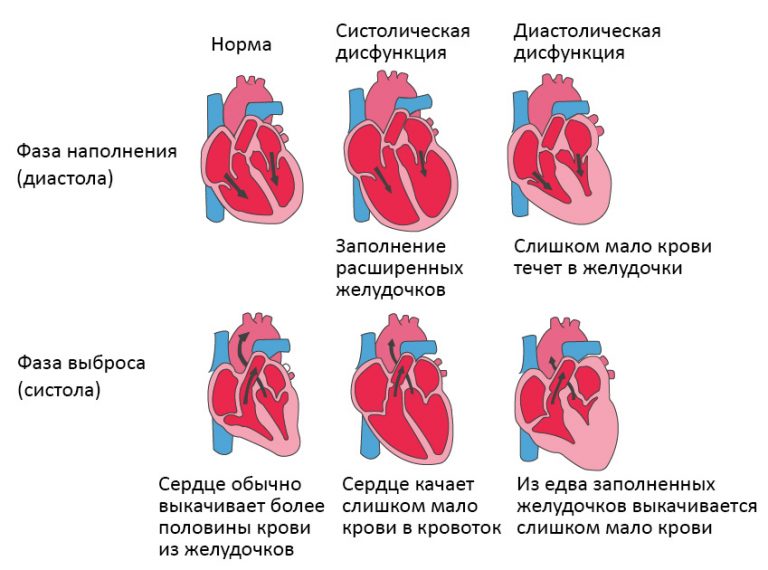 Сердечная недостаточность патофизиология презентация
