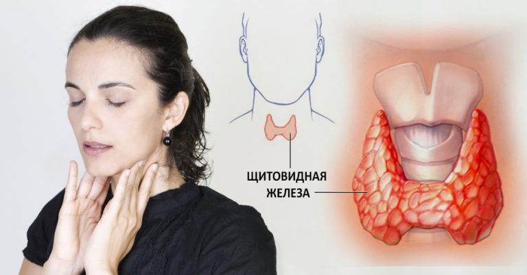 Заболевания щитовидной железы: симптомы илечение