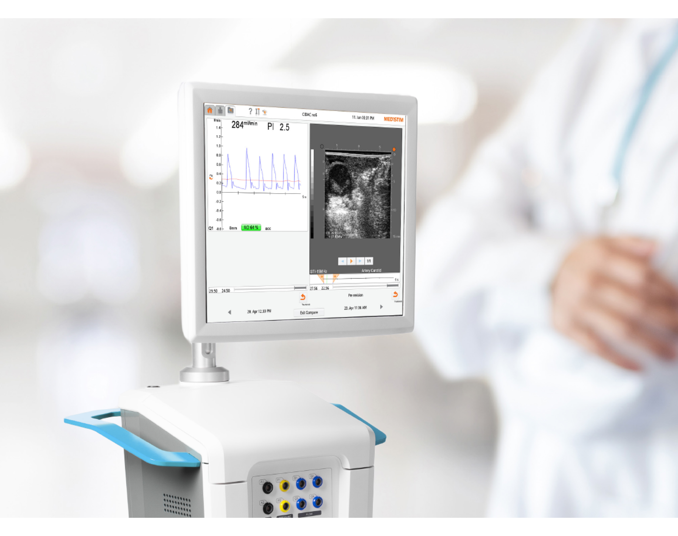 Могут ли кардиохирурги «видеть» качество операции на сердце в реальном времени?