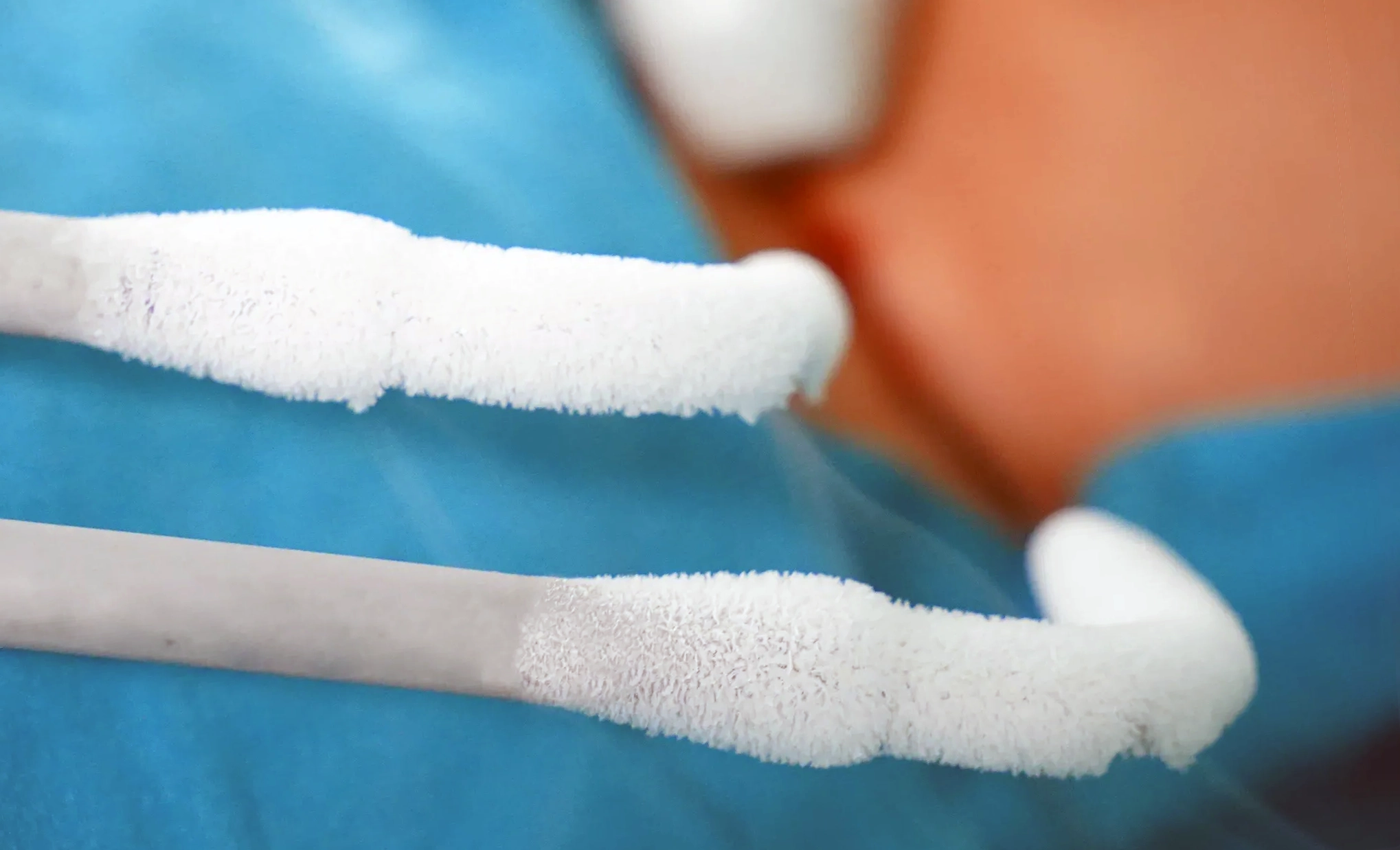 Что такое криоаблация