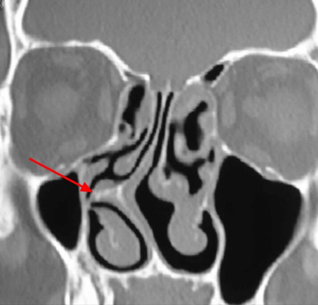 Под рентгеном