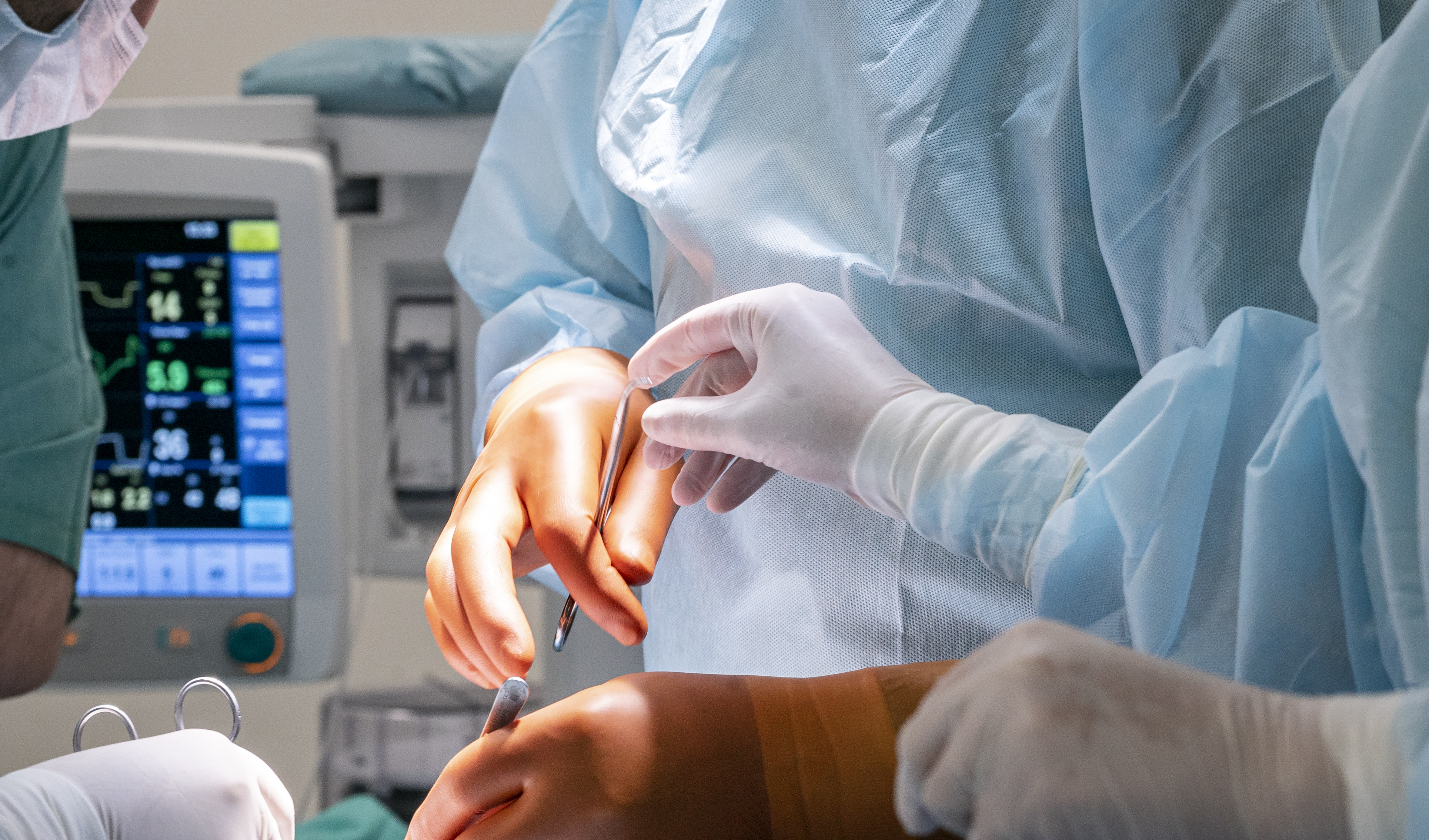 32 миоматозных узла через 3 разреза удалили молодой пациентке в ГКБ им. В.В.Вересаева